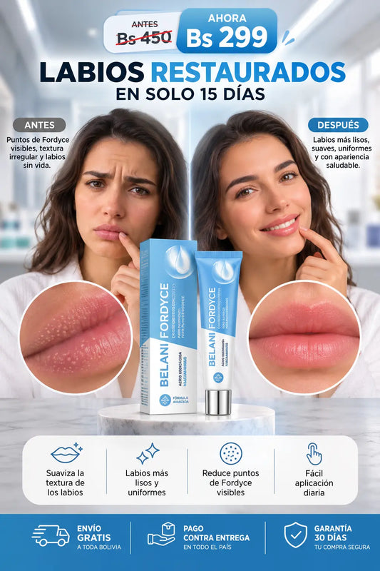 Belani Fordyce : Dile adios a las manchas en tus labios